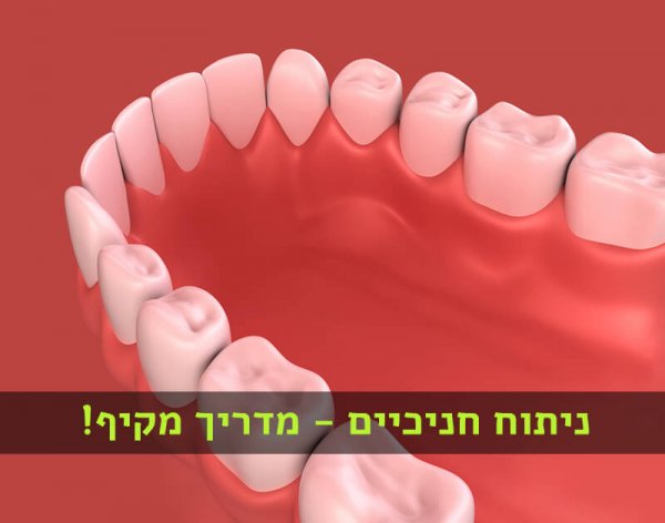 ניתוח חניכיים ניתוח חניכיים