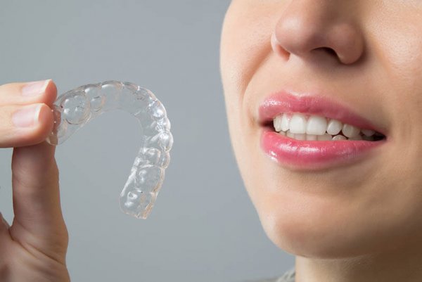 אינויזליין Invisalign יישור שיניים