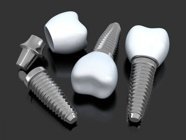 שתלי זיגומה