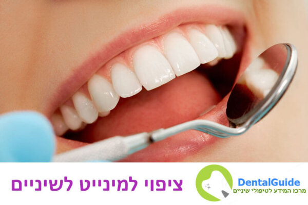 ציפוי למינייט