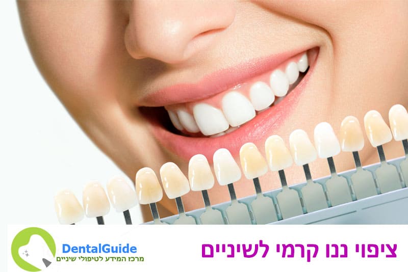 ציפוי ננו קרמי לשיניים