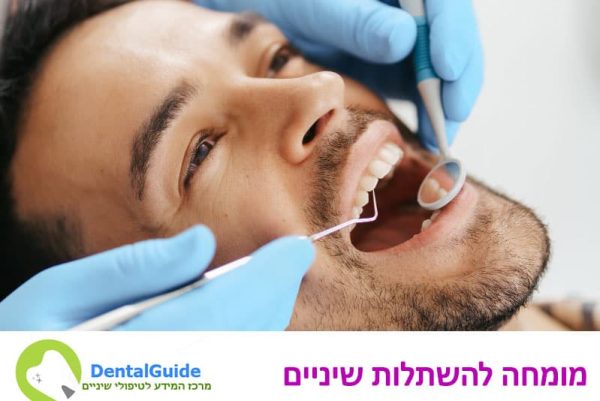 מומחה-להשתלות-שיניים מומחה להשתלות שיניים